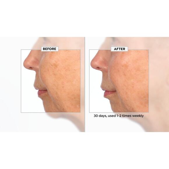 Active Argan Resurface Accelerating Peel Activated Argan Complex, 1.0 fl oz. New - Picture 5 of 16